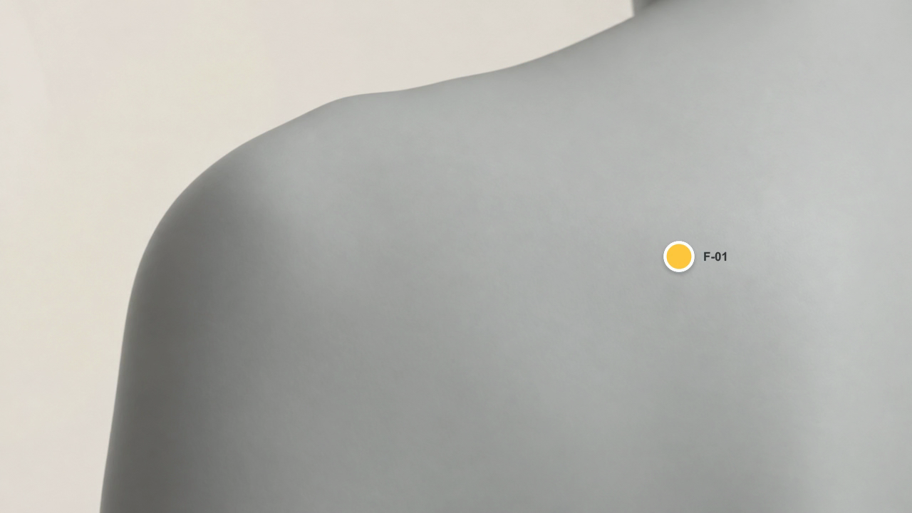 Representação ilustrativa do corpo com marcador de uma lesão